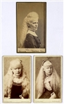 Trio of 19th Century Albino “Freak Show” Cabinet Photos Including The Martin Sisters-”Barnum's Albino Beauties!”