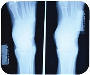 Elvis Presleys X-Ray of His Right Foot from the Day After the February 18, 1973 On-Stage "Attack" at the Las Vegas Hilton! Plus Medical Documents (5)